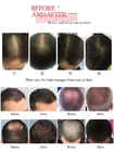 СИД терапией волос машины роста волос лазера ламп лазера диода 260pcs растет